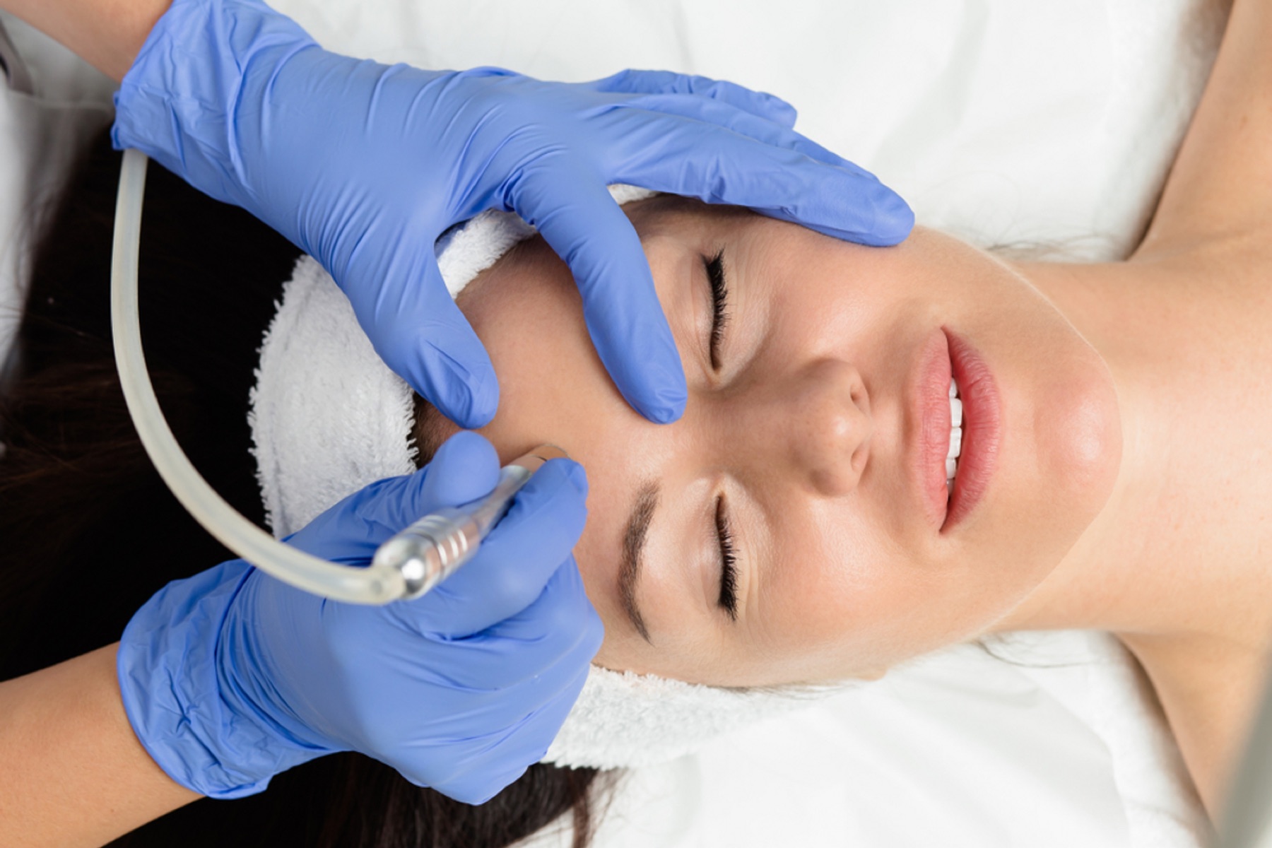 Microdermabrasion treatment performed by an esthetician